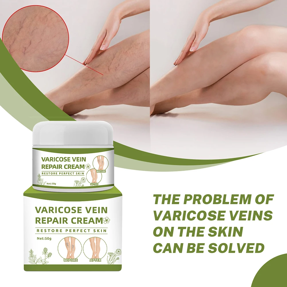 Varicose Vein Cream Leg Swelling Care Suitable for Long-Term Standing and Driving | Красота и здоровье