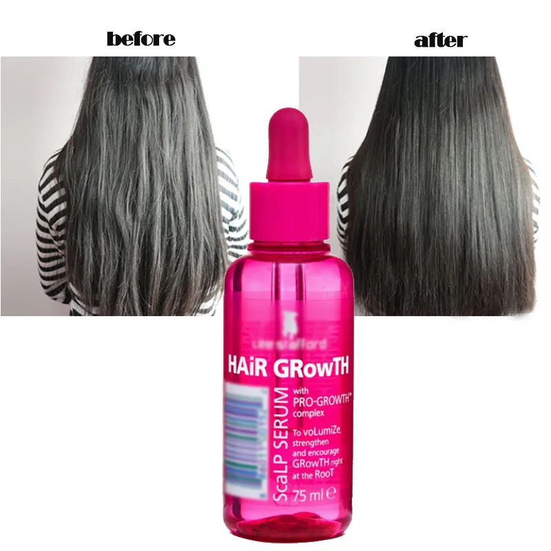 Британское эфирное масло против алопеции 75 мл для ускорения роста волос питает