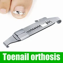 Коррекция вросших ногтей, педикюр, уход за ногами, инструменты для ухода за ногтями, выпрямляющий зажим, корректор, инструмент для коррекции ногтей