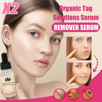 

Organic Tags Solutions Serum Herbal Treatment Serum Remove Unwanted Skin Flaws 2 Pc Dead Skin Removal 20ML Dropshipping #