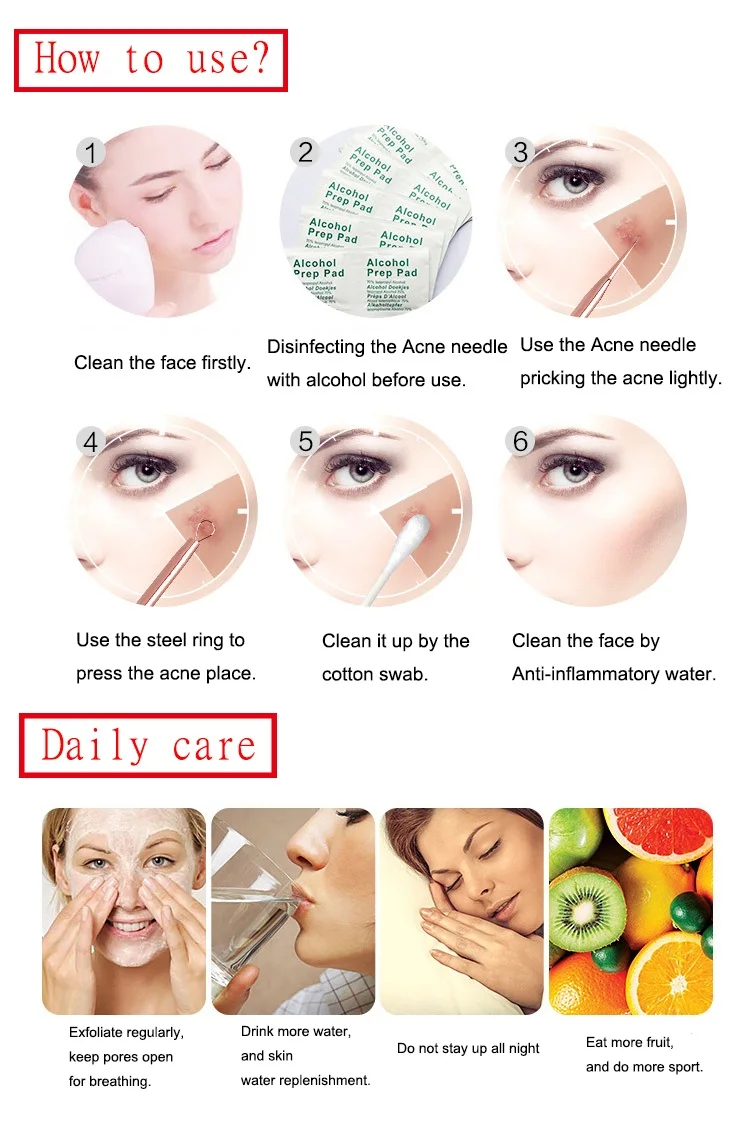 acne-blackhead-reomver-tool