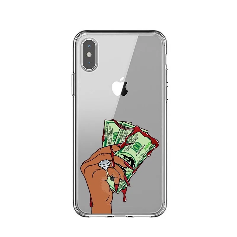 399