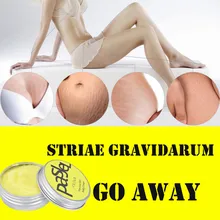 Striae gravidarum восстанавливающий крем с новым узором, удаление крем от растяжек жира шрам striae gravidarum обработки 20g восстанавливающий крем с 920