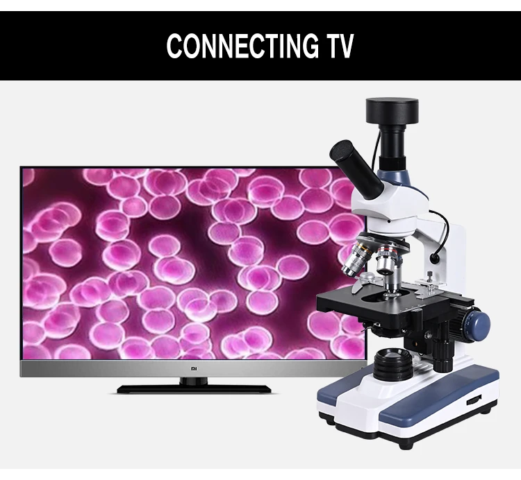 Черный фон HD цифровой биологический лабораторный микроскоп светодиодный свет+ 9-дюймовый ЖК-дисплей+ 5MP электронный окуляр микроскопа+ USB кабель для передачи данных+ металлический ящик