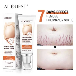 AUQUEST Remove Pregnancy Scars Acne Cream Stretch Mark Treatment Maternity Repair Anti-Aging Anti-Winkle Firming Body Cream MD01
