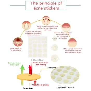 

24pcs Little Stickers Patch Acne Treatment Anti-inflammatory Smoothing Makeup Invisible Acne Patch Face Beauty Acne Remover