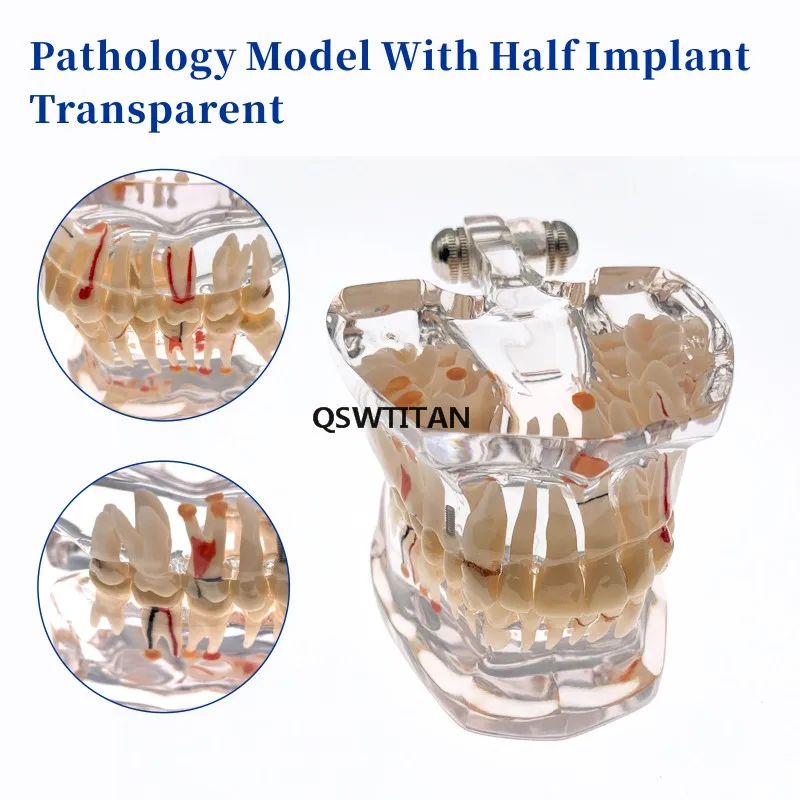 equipamento de laboratório dental, comunicação de dentista-paciente