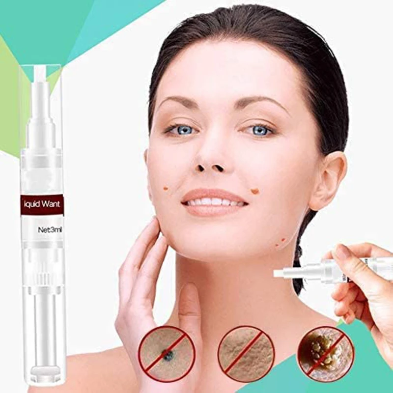 

Skin Tag Mole Wart Remover Liquid WipeOff Tags & Moles Removal Pen Organic Tags Solutions Wart Treatment 3ml