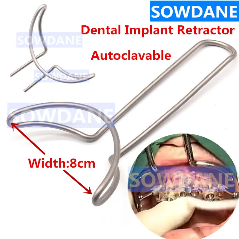 %56Y)1KGH]WZ__ZR%@XU3~7_副本