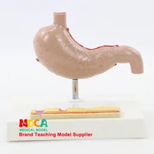 Pathological Stomach Model Gastrointestinal Human Stomach Lesions Teaching Aids Digestion System Medicine Teaching Mcw008
