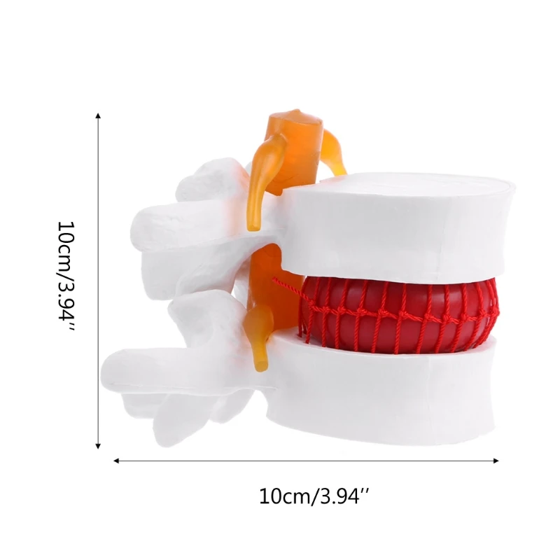 Medical Lumbar Disc Model Human Anatomical