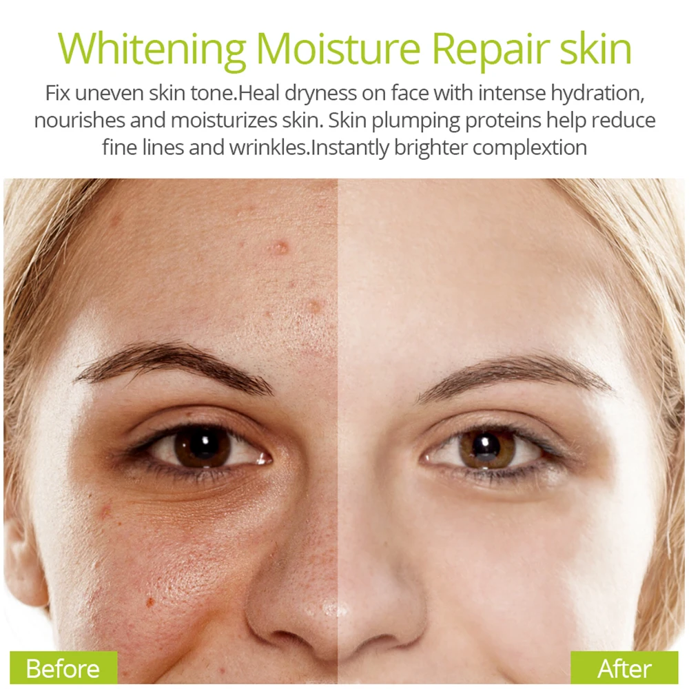 GVIBRANT LAMOUR Vitamin C Whitening Face SerumAnti Aging Hyaluronic Acid Cream Remover Acne Fade Dark Spots 2