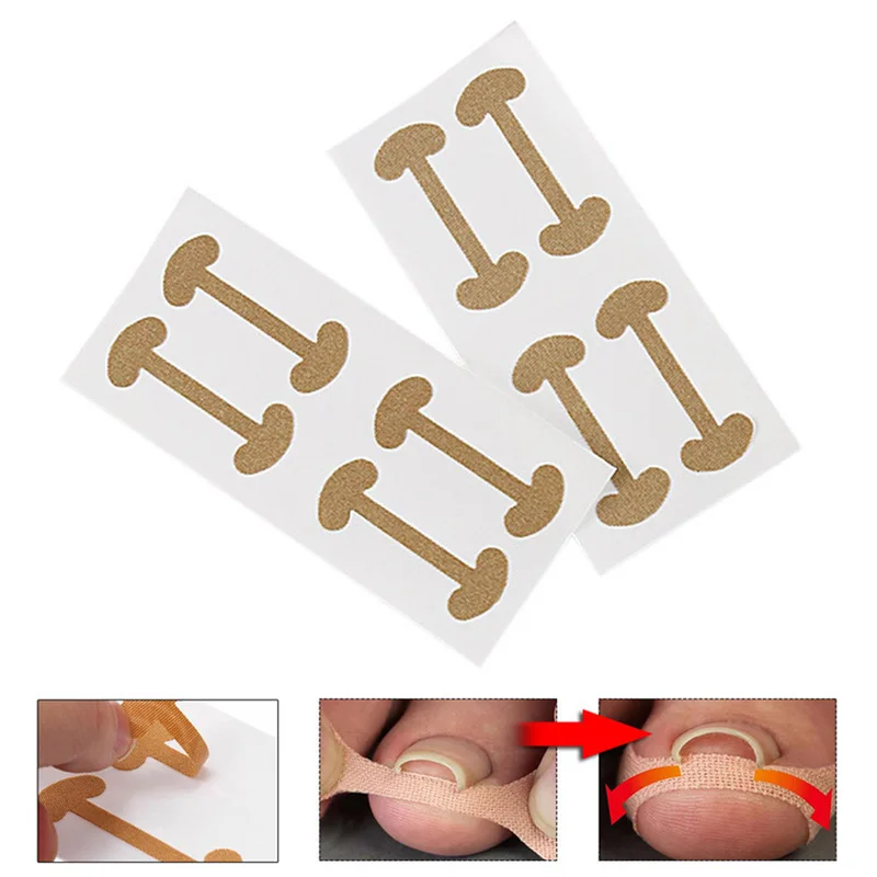 

8 Pcs Ingrown Toenail Corrector Stickers Repairing Corrector Pedicure Tools Fingernail Paronychia Treatment Toe Nail Care