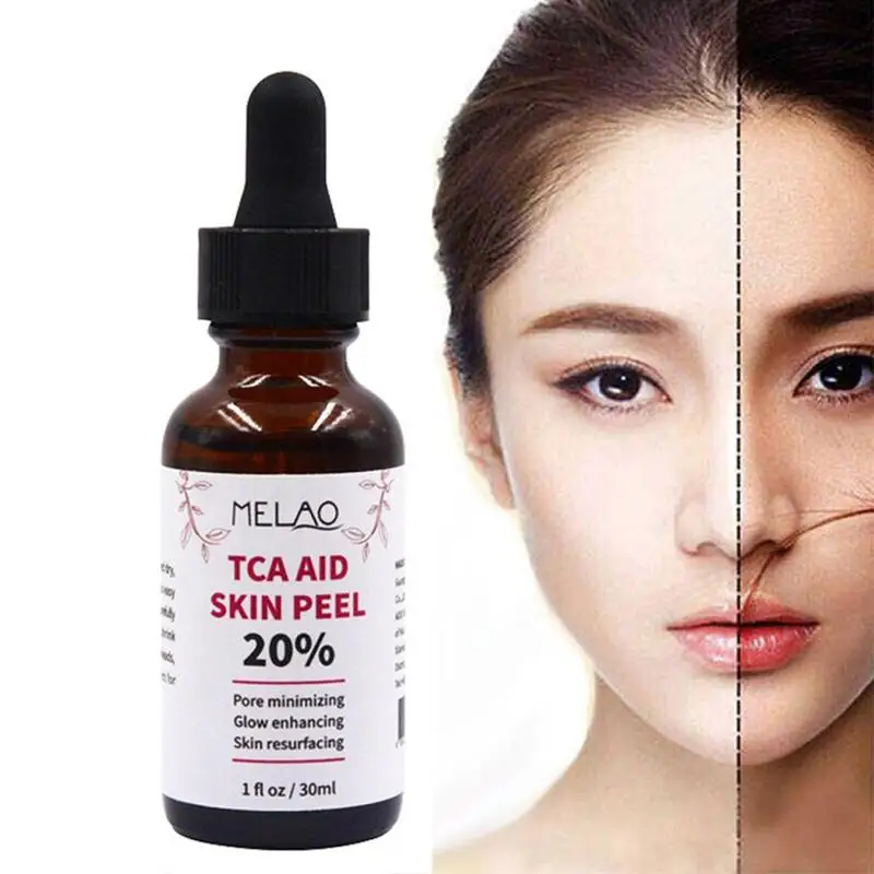 H3ef5b8ec11454d23960aded9512ecc1es 30ml Trichloroaectic Acid 20% Skin Peel Pore Minizing Wrinkles Spots Skin Care Face Serum