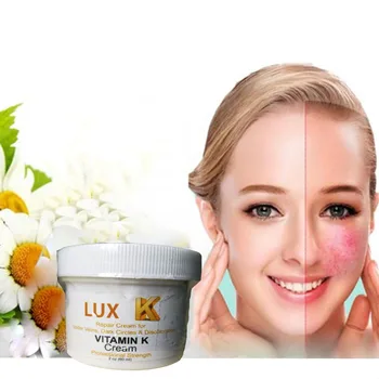 

Vitamin K Cream Thread Spider Varicose Veins Scars Rosacea Capillaries In 2oz (60ml)