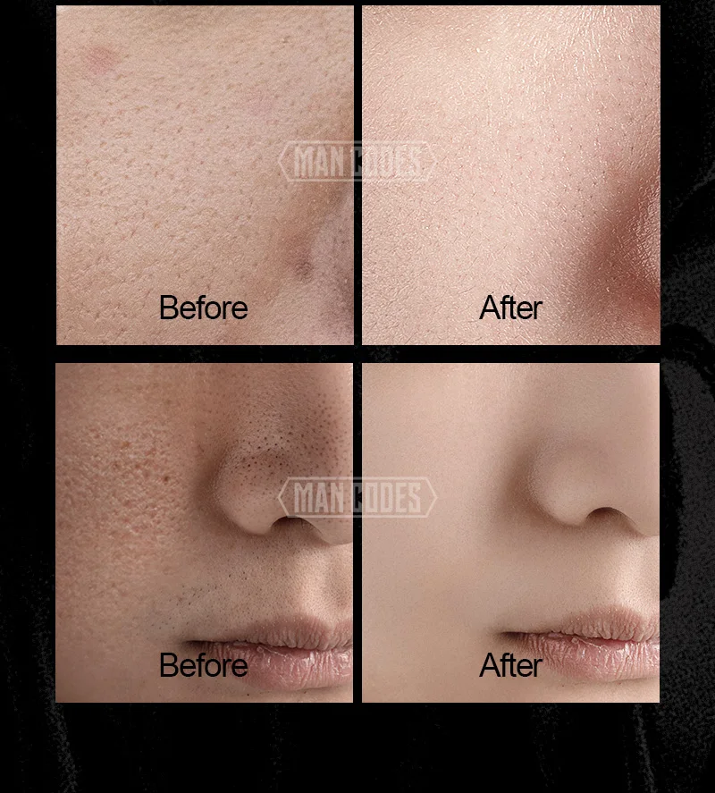 男士乳糖酸精华液详情-水印_10