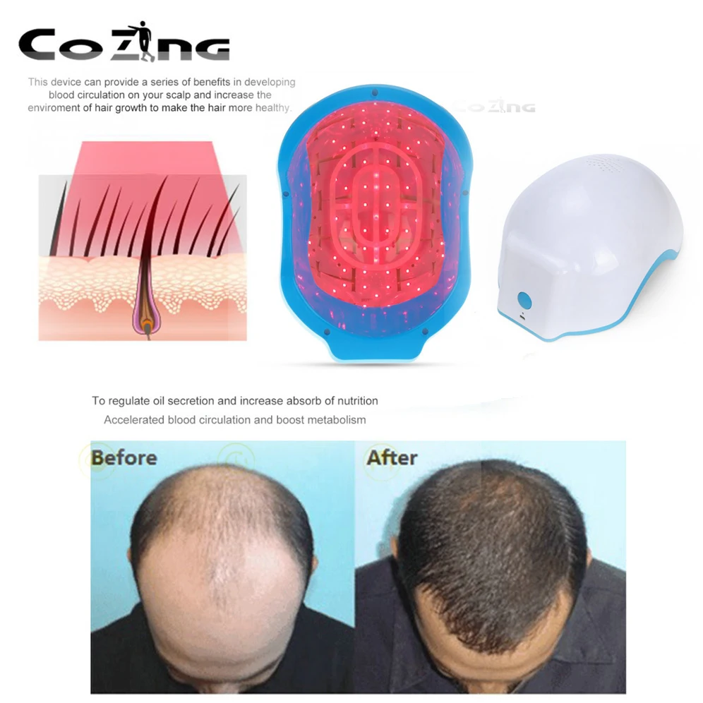 Новейший лазерный шлем 80 медицинских диодов для лечения выпадения волос быстрое отрастание LLLT