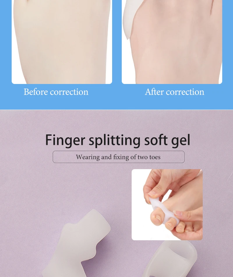 Silikon-Gel-Daumenkorrektor, Hallux-Valgus-Schutz für den kleinen Zeh, Zehenspreizer, Fingerkorrektor, Fußpflege, Schmerzlinderungspolster, Werkzeug – Detail 7
