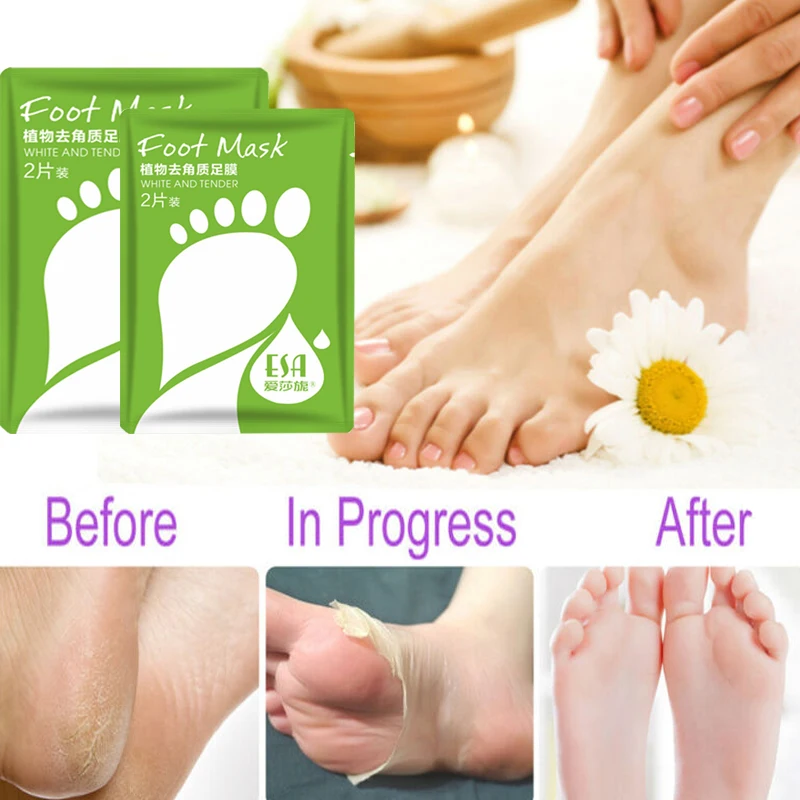 2pcs / Package Foot Exfoliation And Calluses Heel Mask Softening