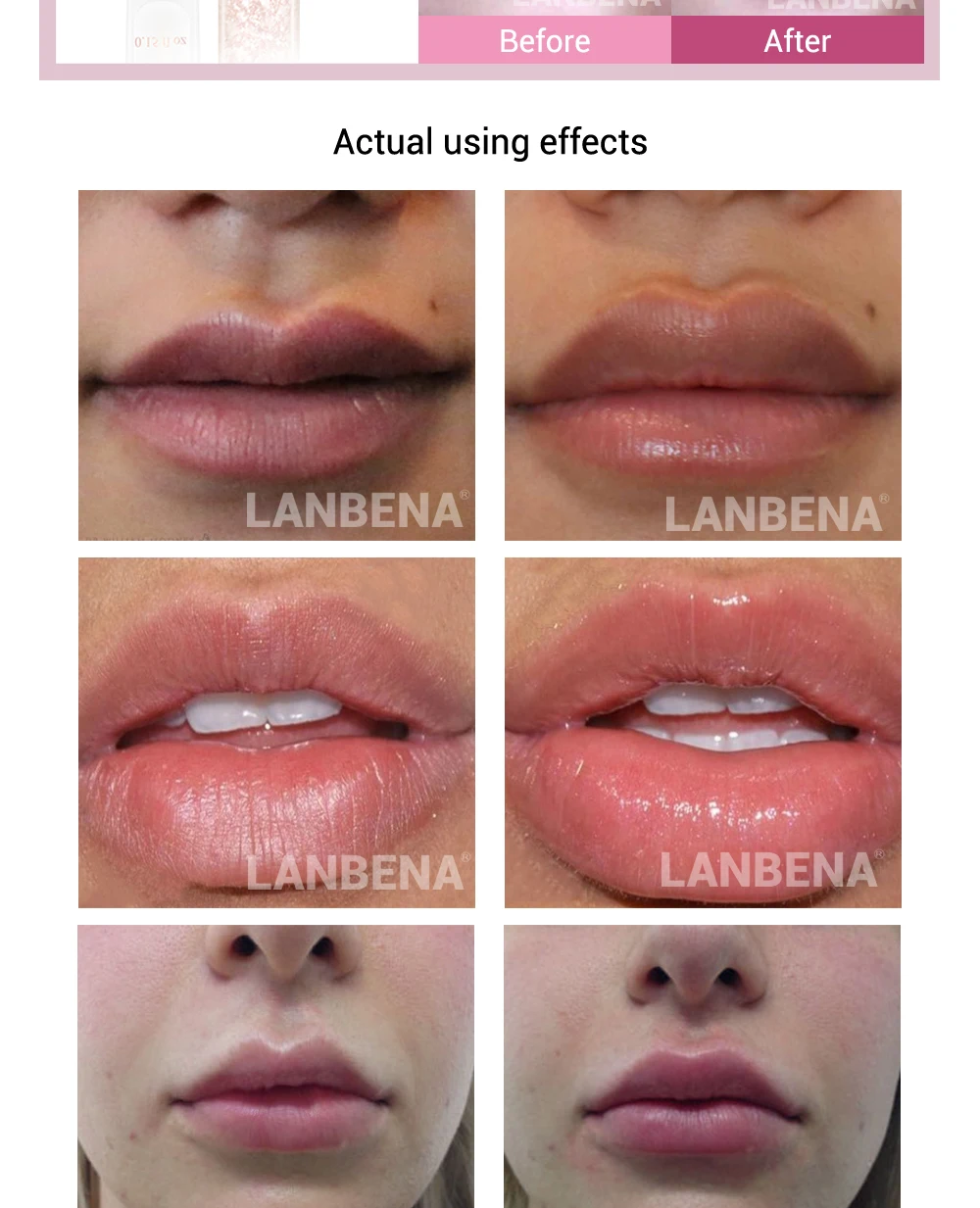 LANBENA Lip Care Serum Moisturizing Repairing Lip Plumper Lip Mask Increase Lip Elasticity Reduce Fine Lines Resist Aging Beauty