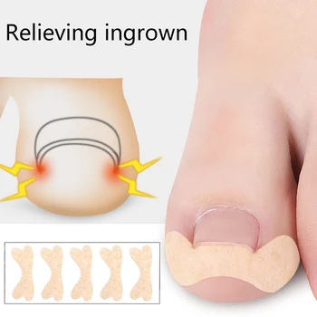 

50pcs Professional Embedded Toe Nail Corrector Sticker Toenail Care Pedicure Thumb Curl Correction Sticker