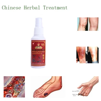 

Snake Gallbladder Detox Massage Essential Oils Medical Acesodyne Ointment For Joint Pain Care Rheumatism Health Spray 100ml