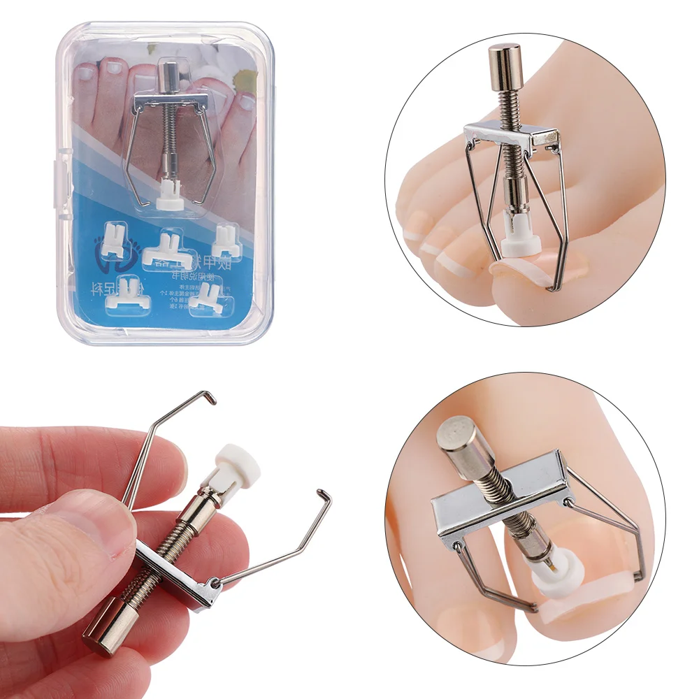 

Nail Clippers Cuticle Pusher Ingrown Toenail Correction Pedicure Tools Paronychia Foot Care Nail Recover Nail Tools