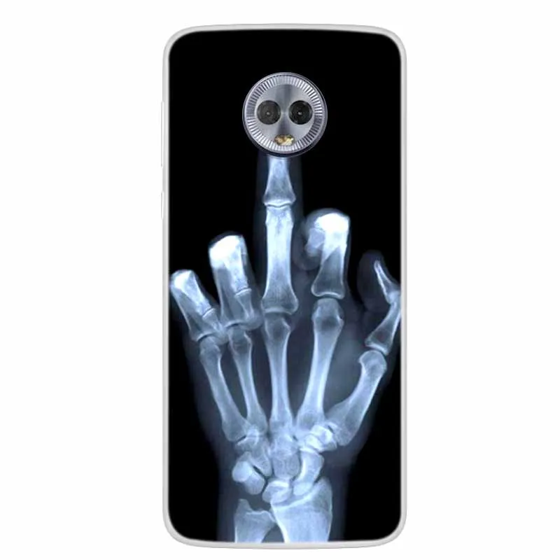 Lovely Cat Soft TPU Silicone Transparent Phone Case | Clear Bumper Cover
