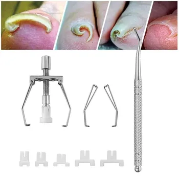 

1 Pcs Toe Nail Fixer Pedicure Recovers Embed Toenail Correction Lifter Tool Set Foot Nail Care Ingrowing Corrector For Toes