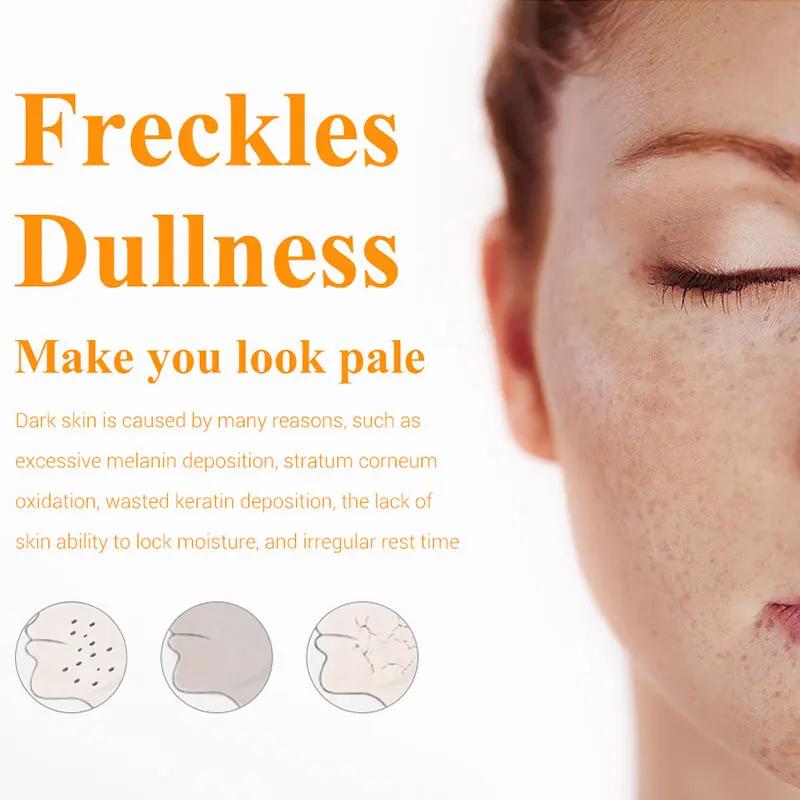 LANBENA Vitamin C Serum 40ml Whitening Facial Essence Remover Speckle Fade Dark Spots Brighten Nourishing Face 2