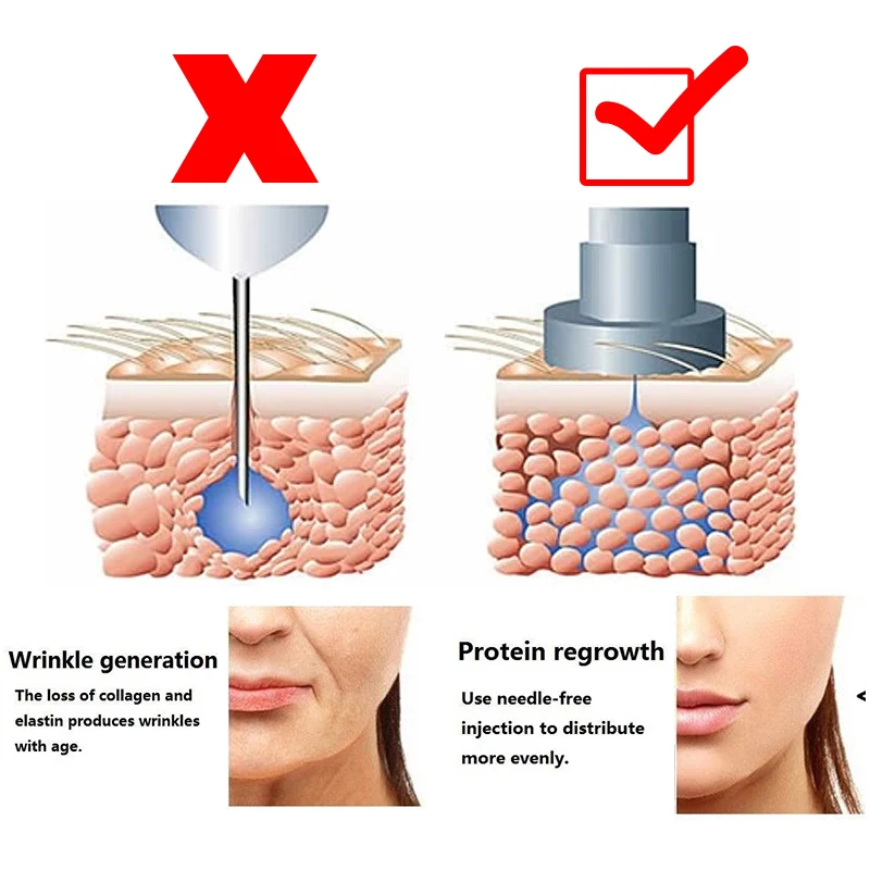 Non Needle Hyaluronic Pen Atomizer Hyaluronic Injection Pen Wrinkle Removal Lip Lifting Anti-aging Facial Beauty Machine Non Needle Hyaluronic Pen Atomizer Hyaluronic Injection Pen Wrinkle Removal Lip Lifting Anti-aging Facial Beauty Machine