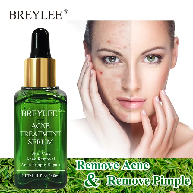 BREYLEE Acne Treatment Face Serum Facial Essence  Removal Scar Cream Anti Acne Pimple Whitening Remover Acne Skin Care 40ml