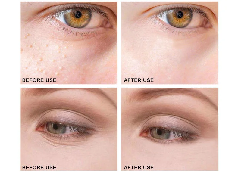 gold-eye-cream_10