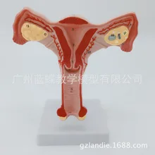 Модель усилителя матки для женщин анатомическая модель для женщин модель для планирования семьи