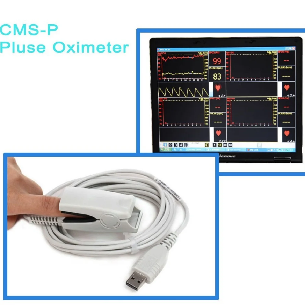 Contec ПК USB интерфейс SpO2 CMS P пульсоксиметр Монитор бесплатное программное