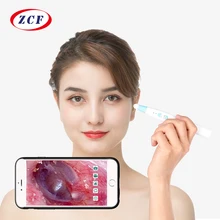 F180B 3,9 мм Объектив wifi отоскоп эндоскоп камера отоскопио Медицинский Диагностический комплект беспроводная Чистка ушей выбор ушей с ушными затычками