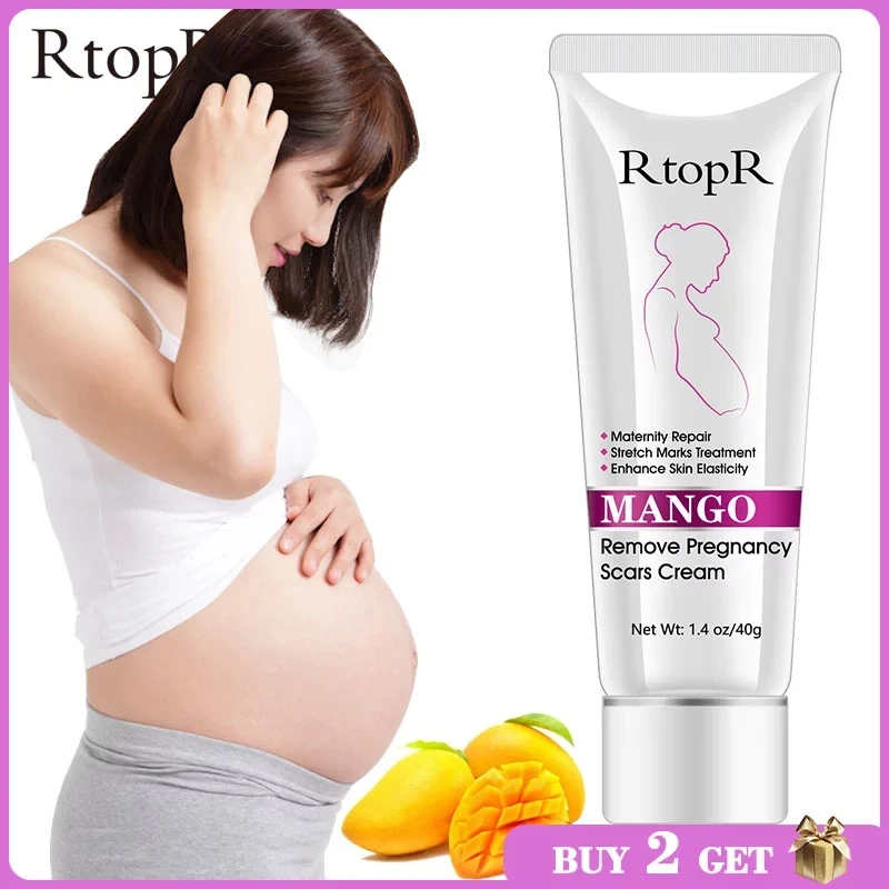 mango anti stretch mark cream