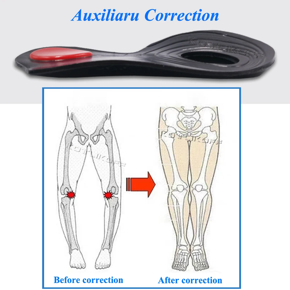 KOTLIKOFF ортопедические стельки O/X-Leg, Подошвенный Фасциит, супинатор, подстилки пятки, стельки, создающие красоту, уход за ногами