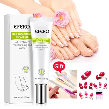 

Fungal Nail Treatment Hand Foot Whitening Feet Care Essence Toe Nail Fungus Removal Gel Anti Infection Paronychia Onychomycosis