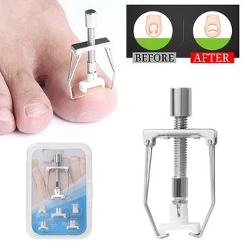 

Ingrown Toe Nail Correction Lifter Pedicure Toenail Fixer Recover Onyxis Bunion Foot Care Tool Set