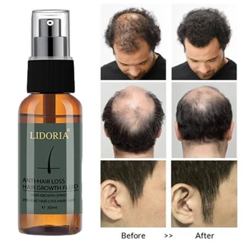 

30ml Hair Growth Essence Spray Product Preventing Baldness Consolidating Anti Hair Loss Nourish Roots Hair Care Dropshipping