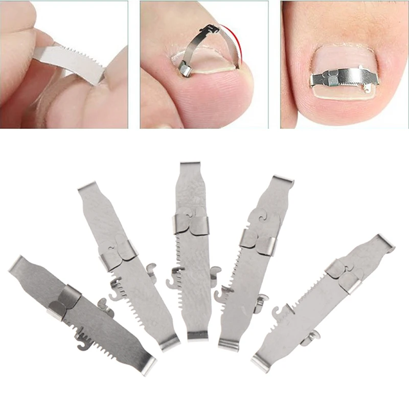 New Ingrown Toe foot Nail Correction Fixer Pedicure Tool Toenail Corrector | Красота и здоровье