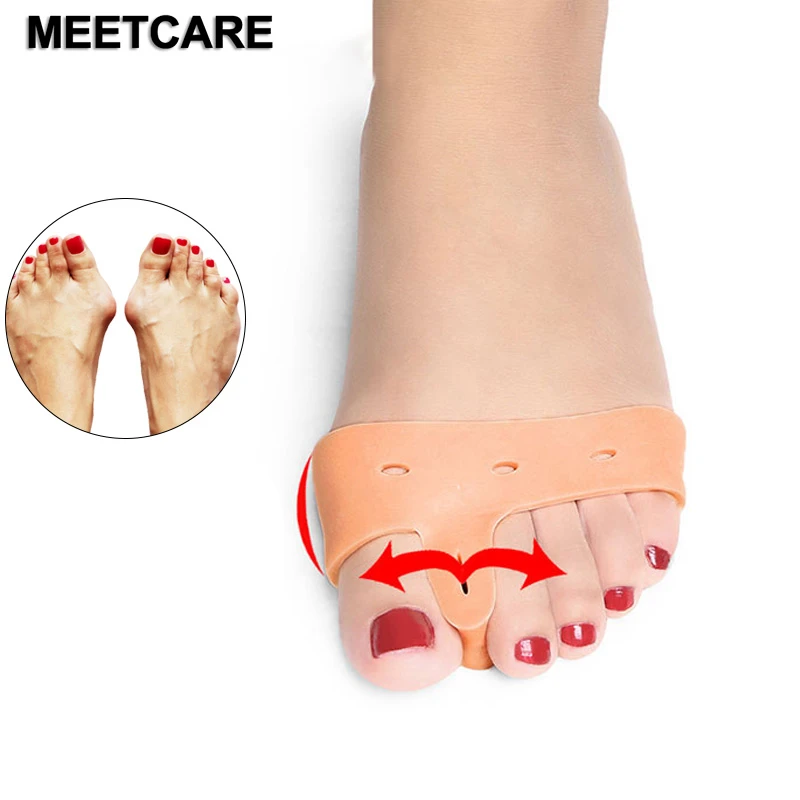 Vive Bunion Corrector For Women Men (Pair) Big Toe Brace Straightener