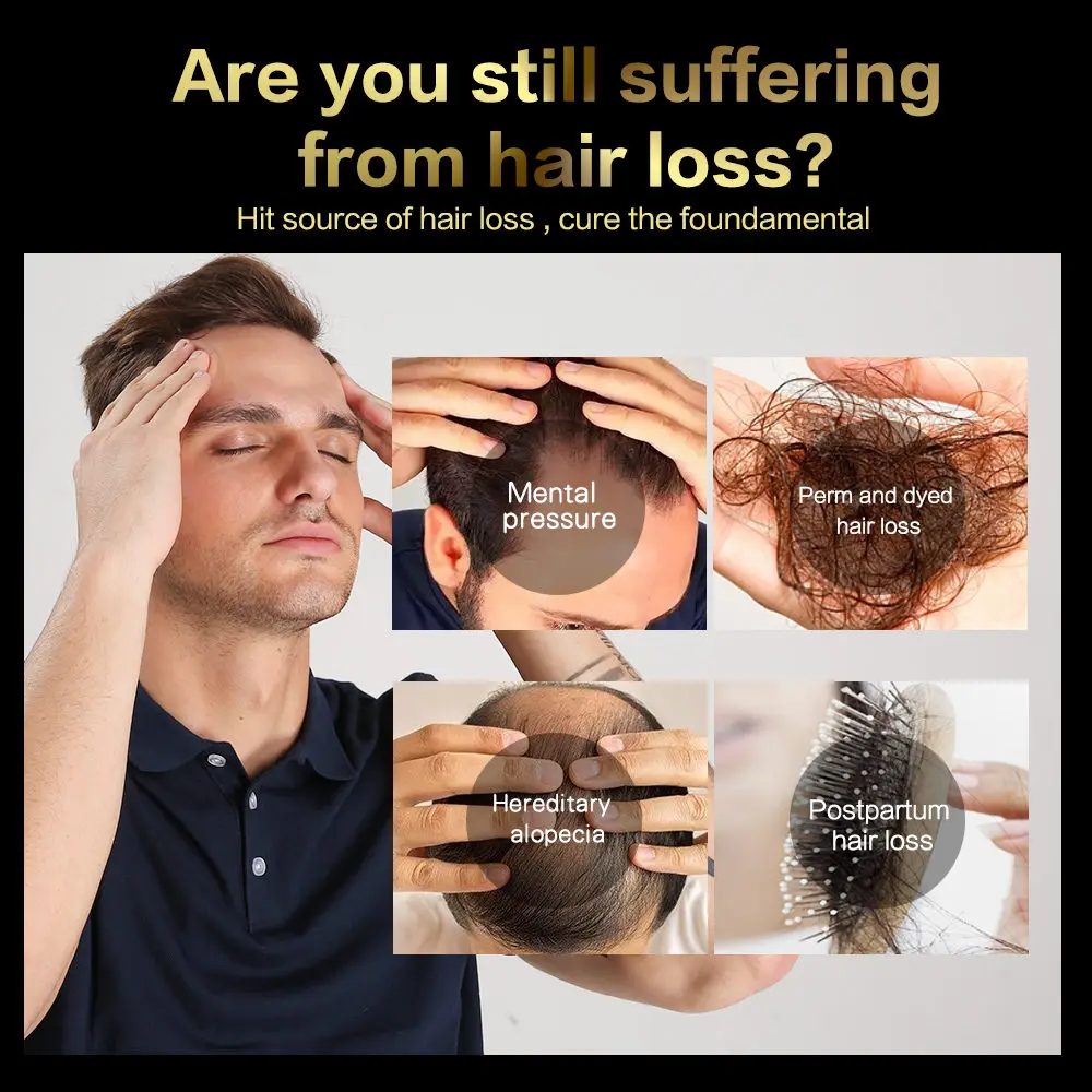 Быстрое эфирное масло для роста волос против потери волос Жидкое восстановление поврежденных волос продукты для ухода за волосами для женщин и мужчин