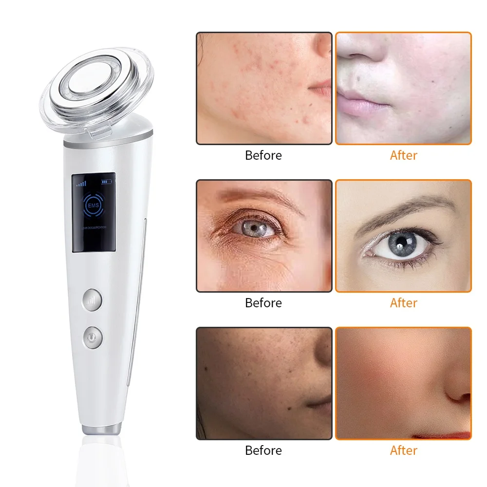  LCD RF Radio Frequency Machine Skin Rejuvenation EMS LED Photon Vibration Facial Tighten Face Lift 