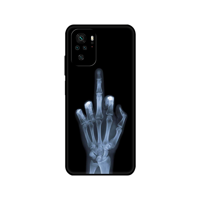 Xiaomi Redmi Note 10 Case 4G 5G Back cover For Redmi Note 10 Pro Phone Cover on Redmi Note 10S bumper silicon black tpu case