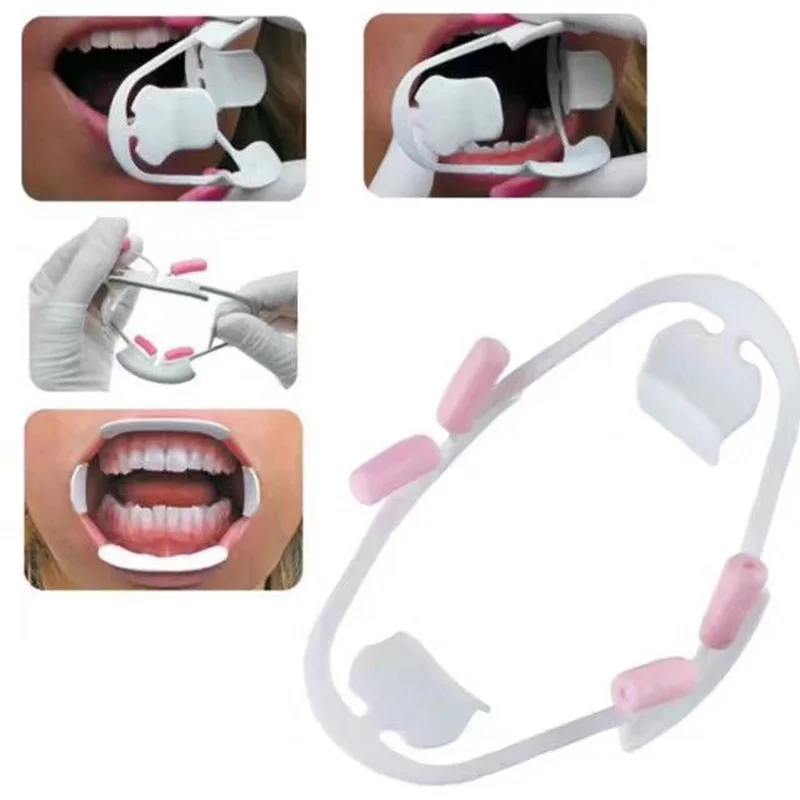 

3D Oral Dental Mouth Opener Intraoral Cheek Lip Retractor Prop Orthodontic Tool for Adult and Child Small/Large Teeth whitening