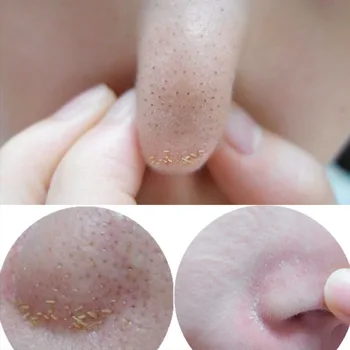 

Facial minerals deep Cleansing Pad Face Nose herbal Blackhead Remover face mask 1pcs/Lot 70