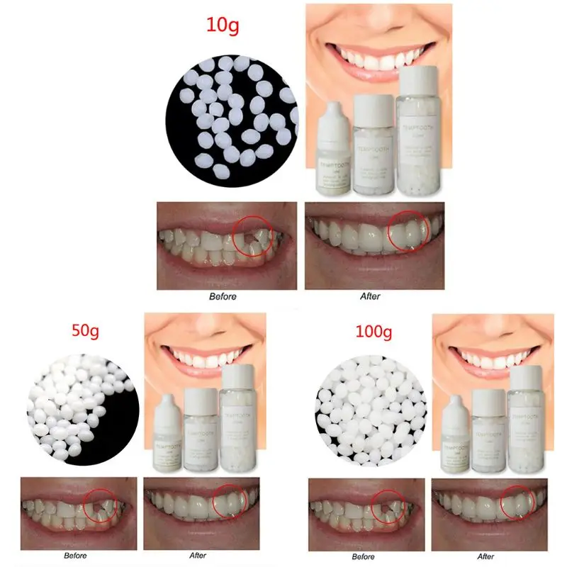 

Temporary False Teeth Gaps Repair Kit Vampire Adhesive Denture Solid Glue Tool