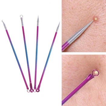

4Pcs Blackhead Facial Acne Pimple Pore Remover Tweezer Curve Extractor Set Kit